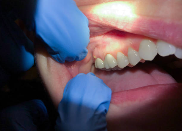 Best After-Hours Dental Trauma Care in San Antonio, FL