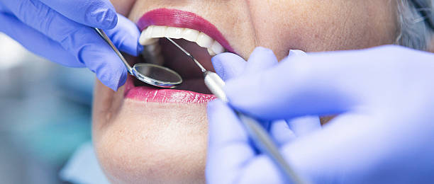 Best Cosmetic Emergency Dentistry in San Antonio, FL
